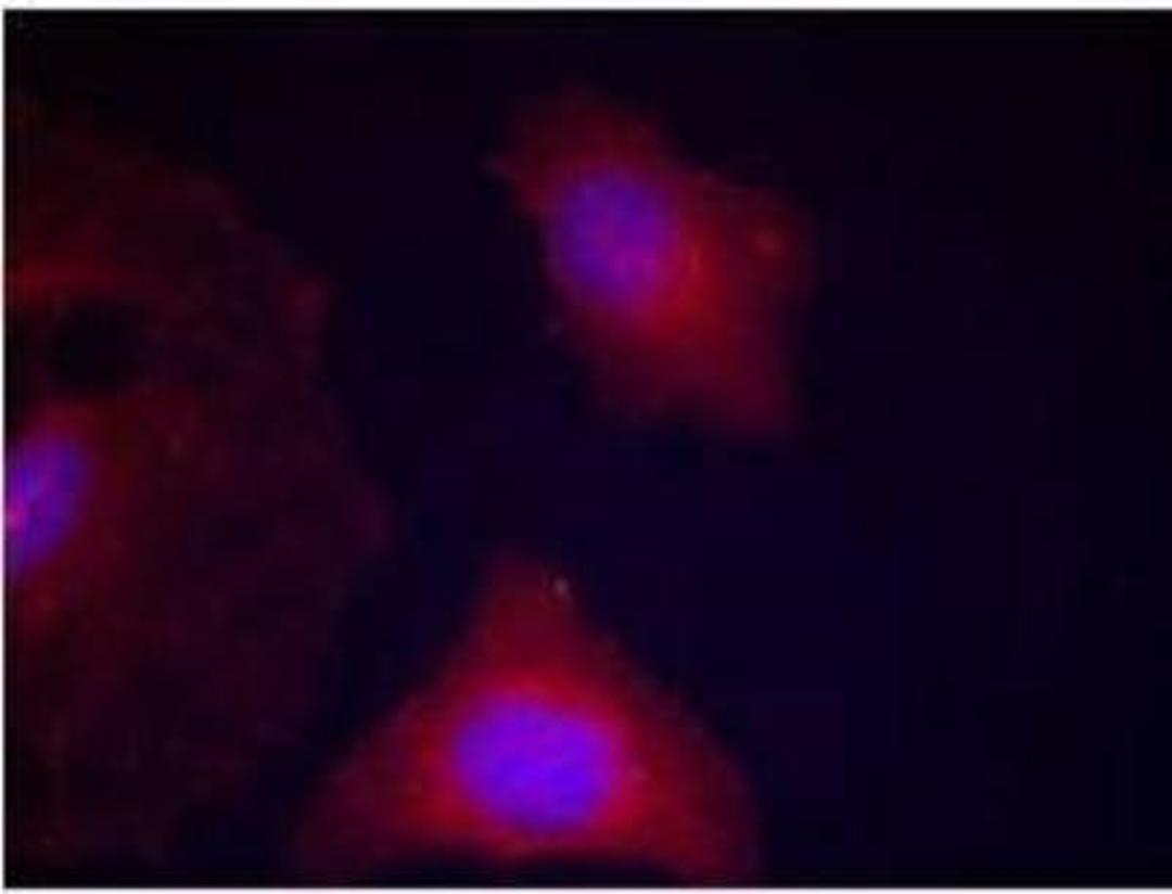 Immunocytochemistry/Immunofluorescence: GSK-3 beta [p Tyr216] Antibody [NB100-81946] -  Staining of Methanol-fixed Hela cells.