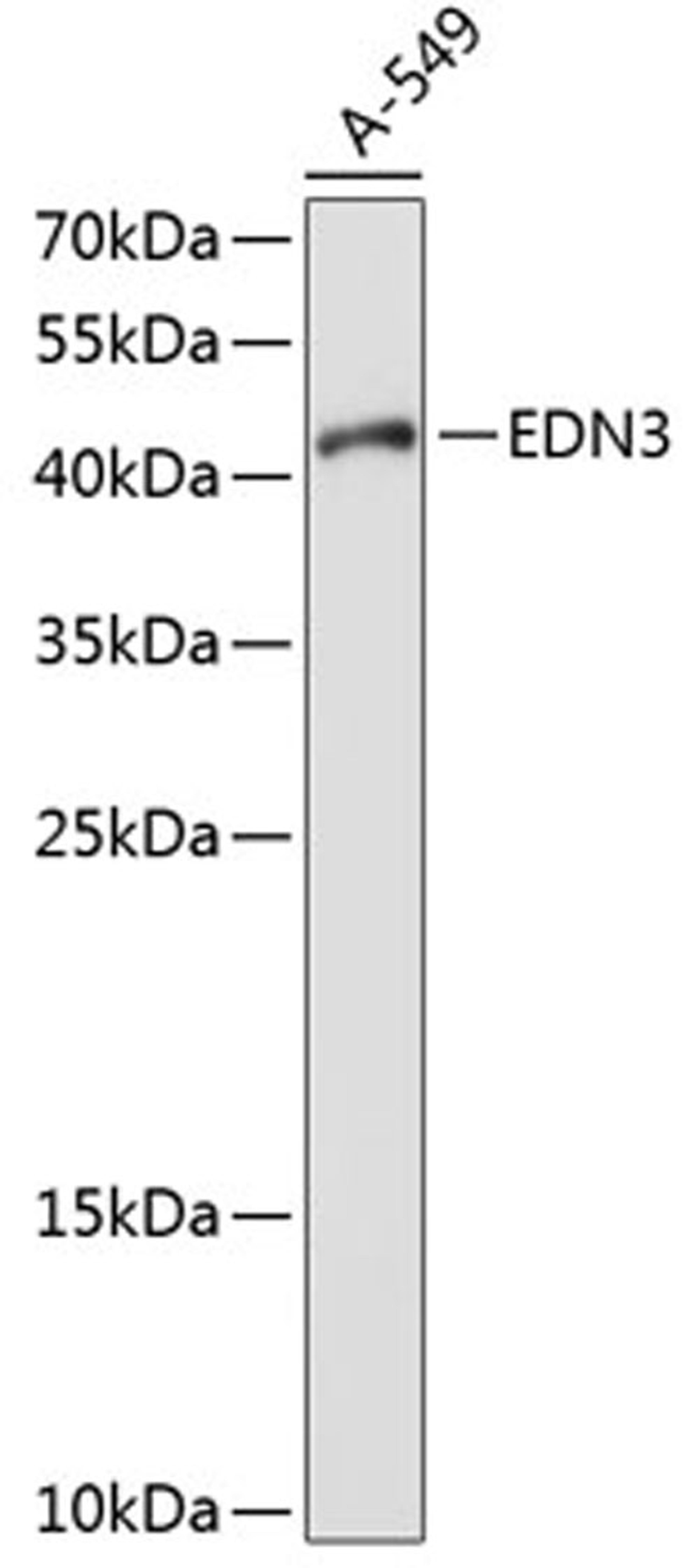 Western blot - EDN3 antibody (A1045)