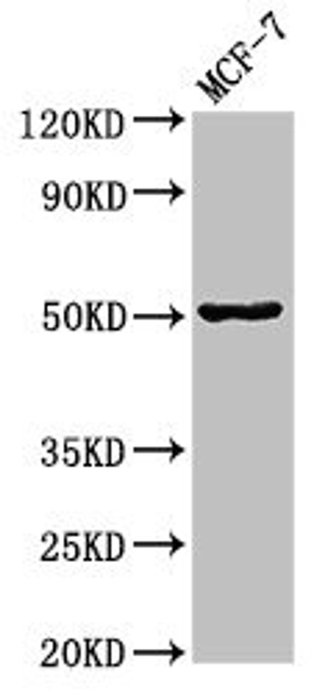 Western Blot. Positive WB detected in: MCF-7 whole cell lysate. All lanes: GFAP antibody at 3.4ug/ml. Secondary. Goat polyclonal to rabbit IgG at 1/50000 dilution. Predicted band size: 50, 51 kDa. Observed band size: 50 kDa. 
