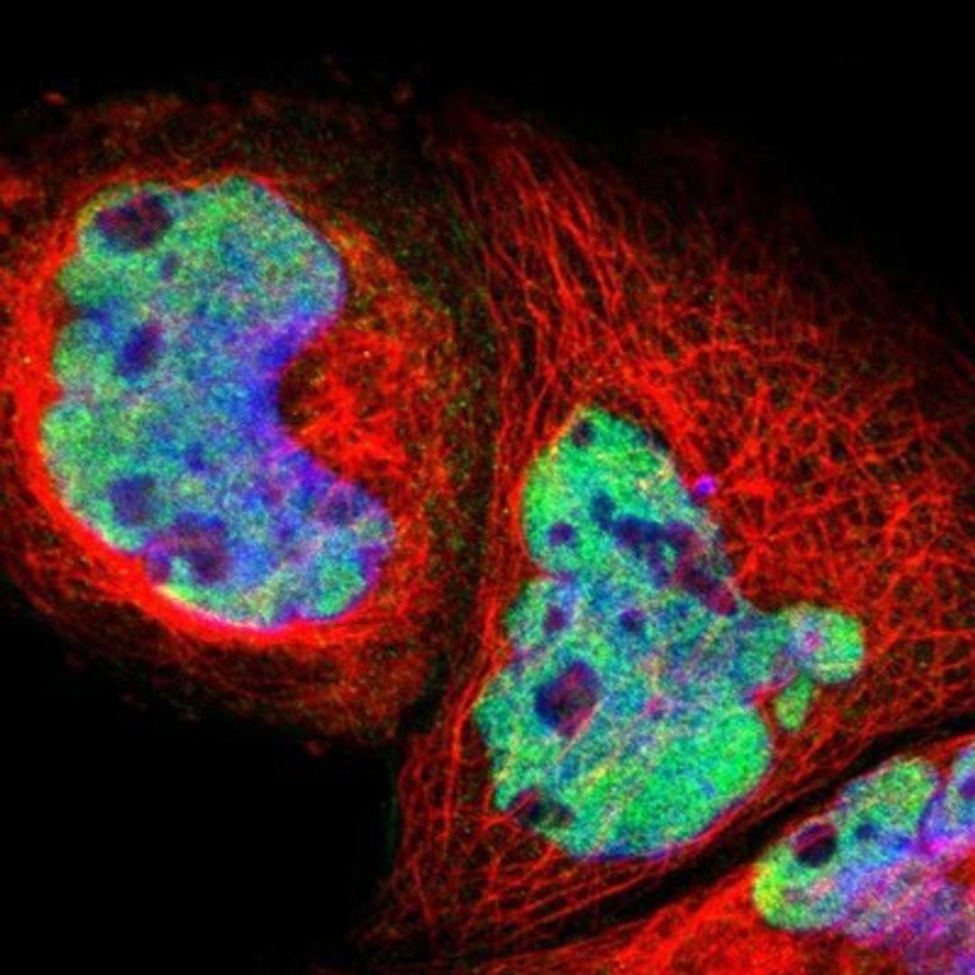 Immunocytochemistry/Immunofluorescence: PRPF39 Antibody [NBP1-83774] - Staining of human cell line A-431 shows positivity in nuclei but not nucleoli.