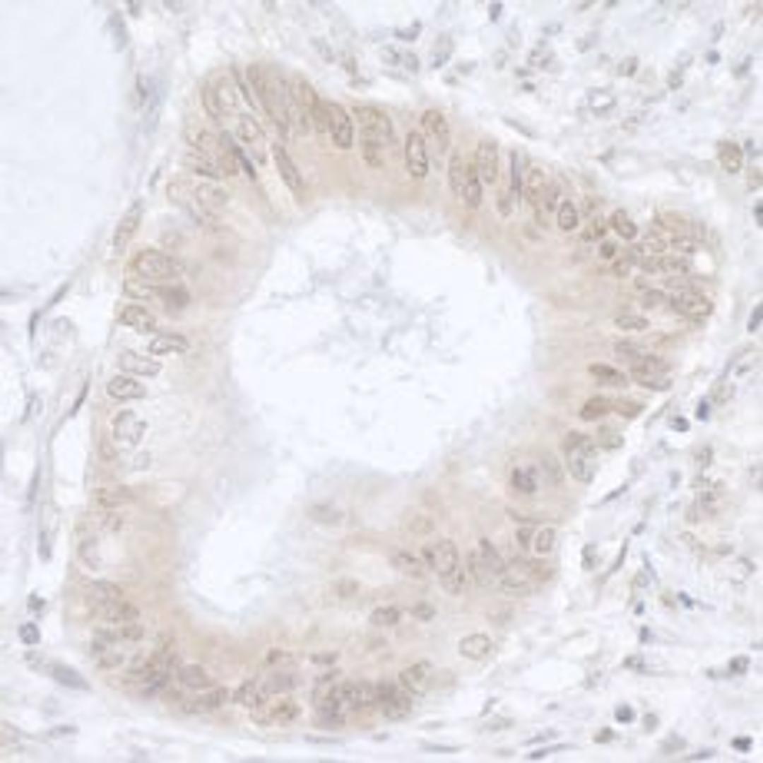 Detection of human USP36/DUB1 by immunohistochemistry.