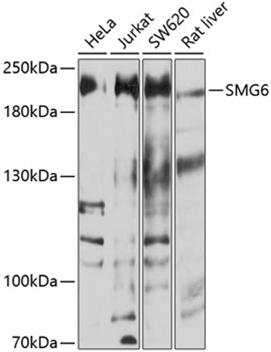 Western blot - SMG6 antibody (A10141)