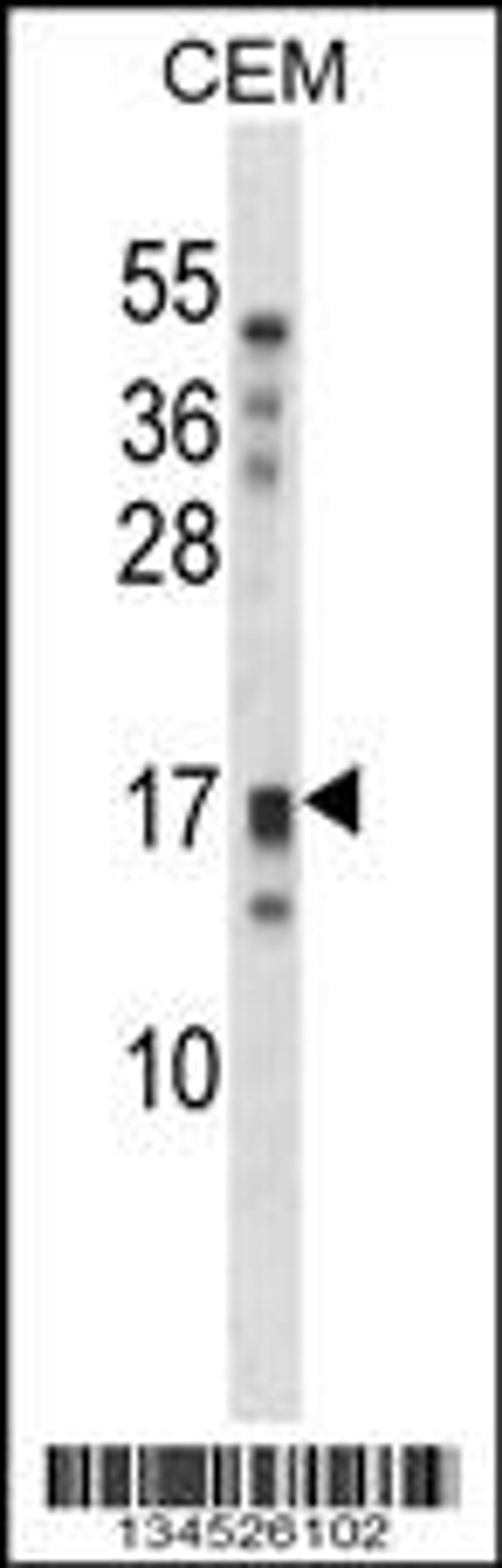 Western blot analysis in CEM cell line lysates (35ug/lane).