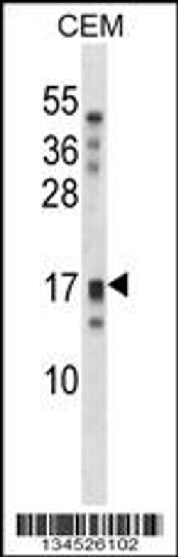 Western blot analysis in CEM cell line lysates (35ug/lane).