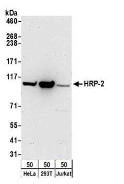 Detection of human HRP-2 by western blot.