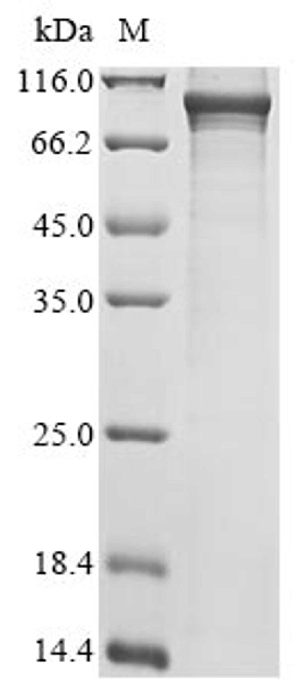 (Tris-Glycine gel) Discontinuous SDS-PAGE (reduced) with 5% enrichment gel and 15% separation gel.