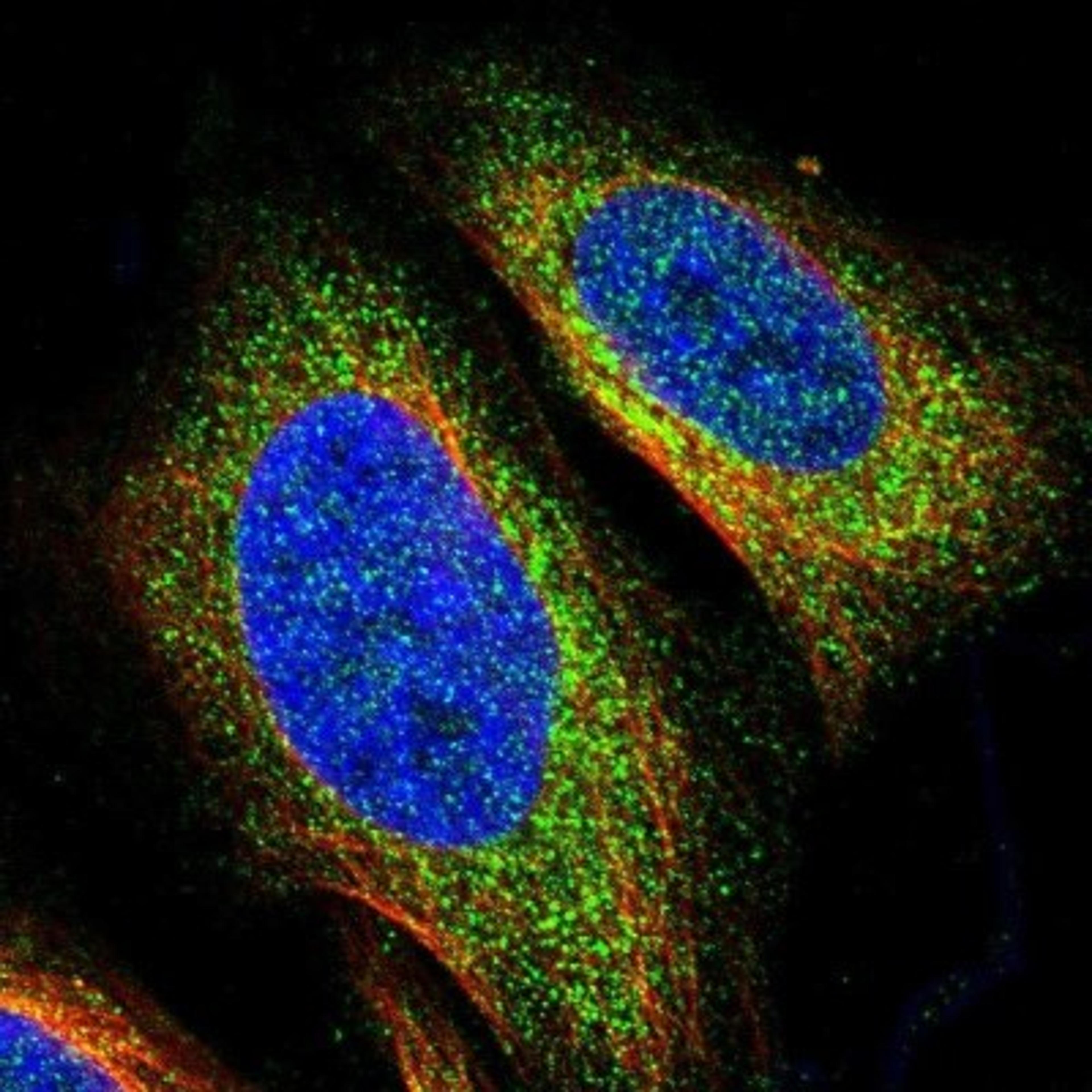 Immunocytochemistry/Immunofluorescence: DHX58 Antibody [NBP1-85348] - Staining of human cell line U-2 OS shows positivity in cytoplasm.