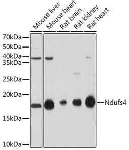 Western blot - NDUFS4 Rabbit mAb (A8691)