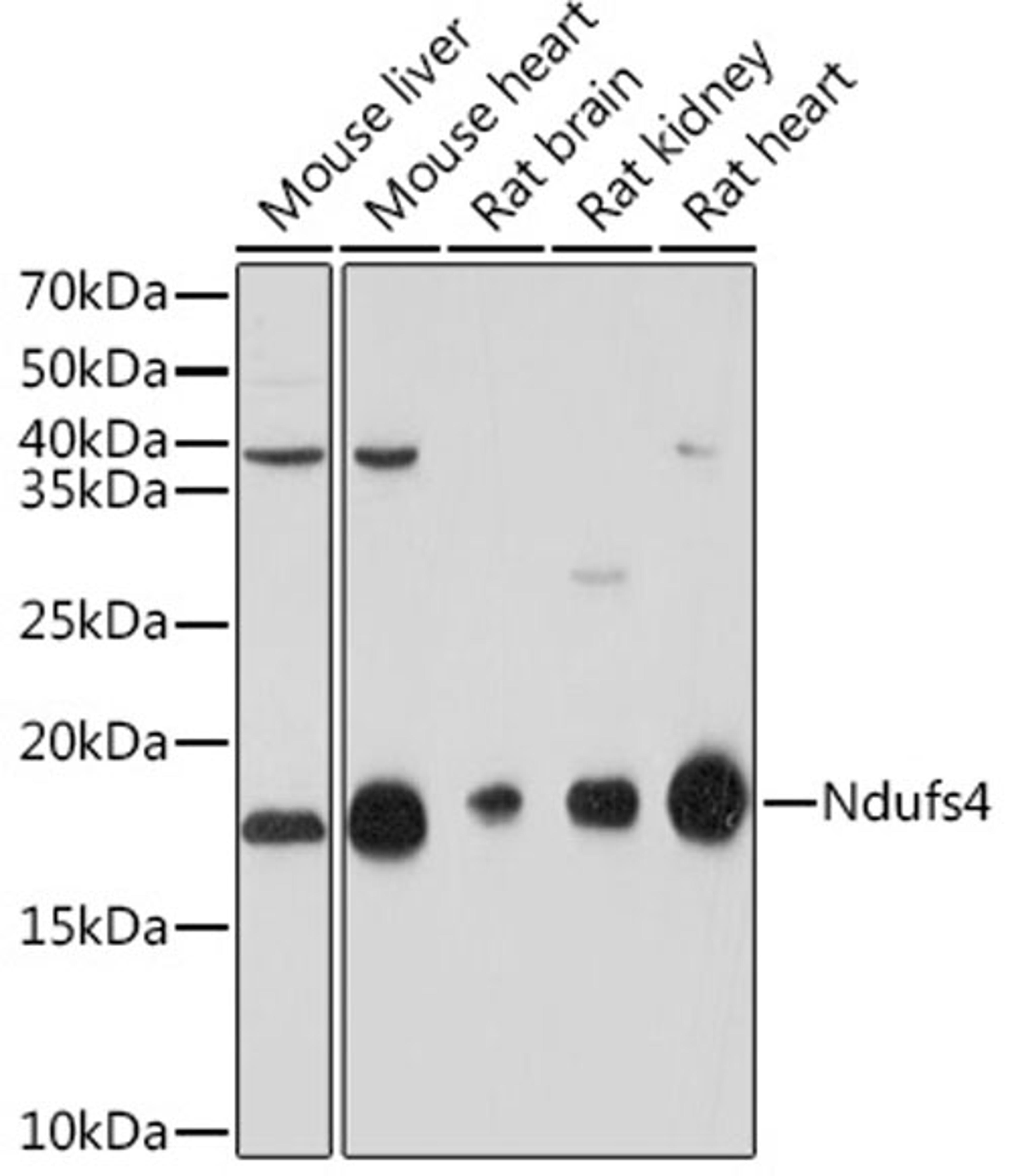 Western blot - NDUFS4 Rabbit mAb (A8691)