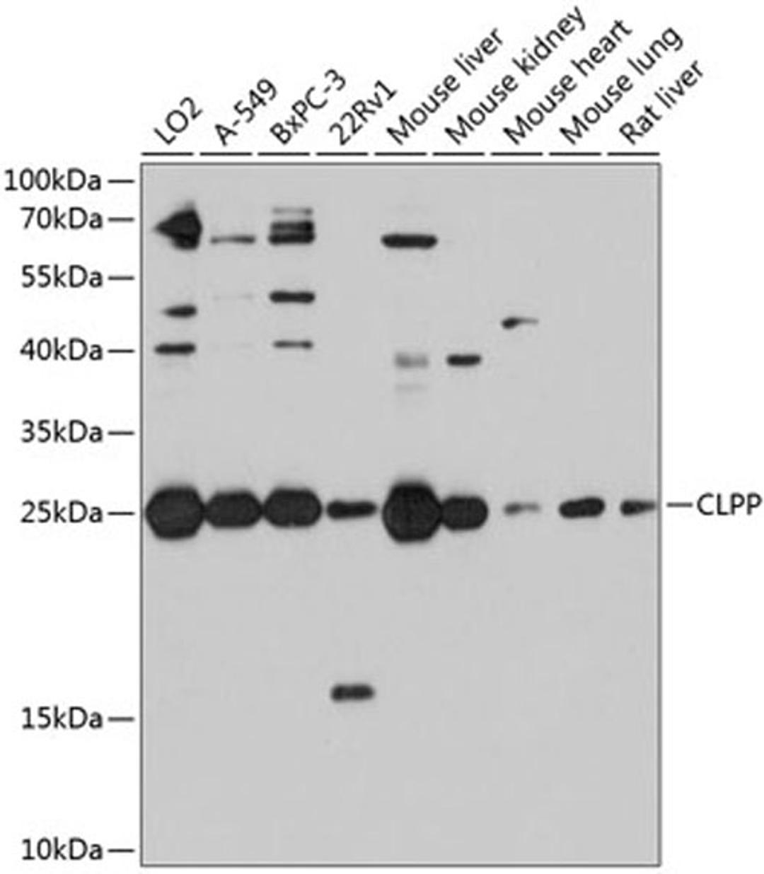 Western blot - CLPP antibody (A9127)