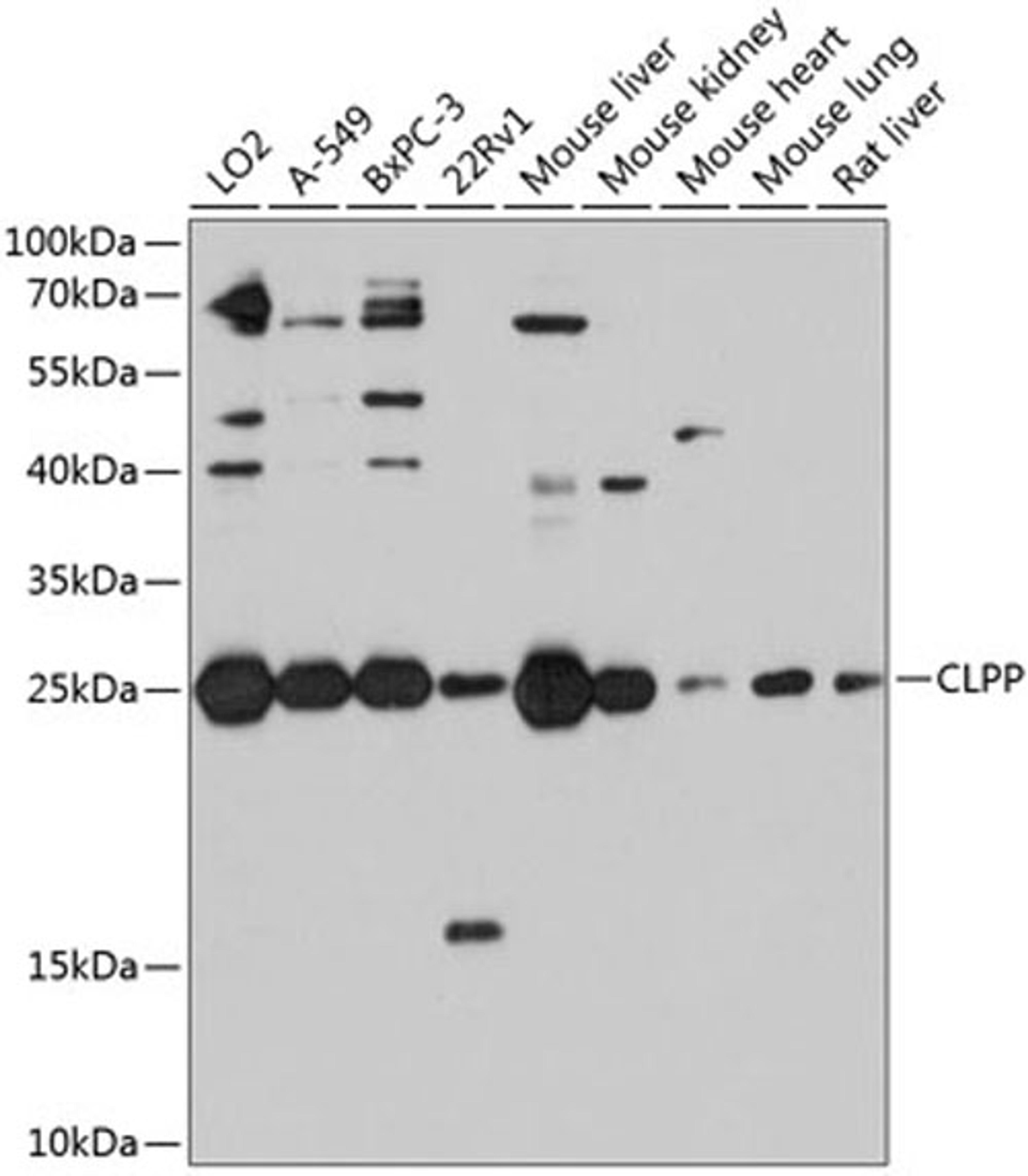 Western blot - CLPP antibody (A9127)