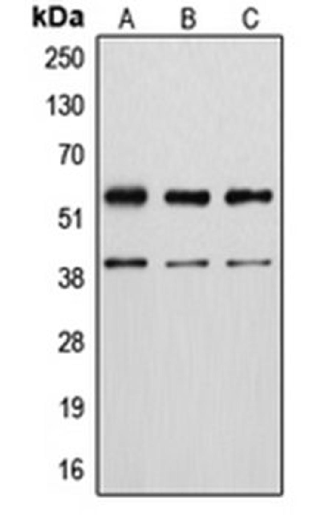 Western blot analysis of MCF7 UV-treated (Lane 1), A10 (Lane 2), KNRK (Lane 3), NIH3T3 UV-treated (Lane 4), H9C2 UV-treated (Lane 5) whole cell lysates using VIM antibody