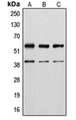 Western blot analysis of MCF7 UV-treated (Lane 1), A10 (Lane 2), KNRK (Lane 3), NIH3T3 UV-treated (Lane 4), H9C2 UV-treated (Lane 5) whole cell lysates using VIM antibody