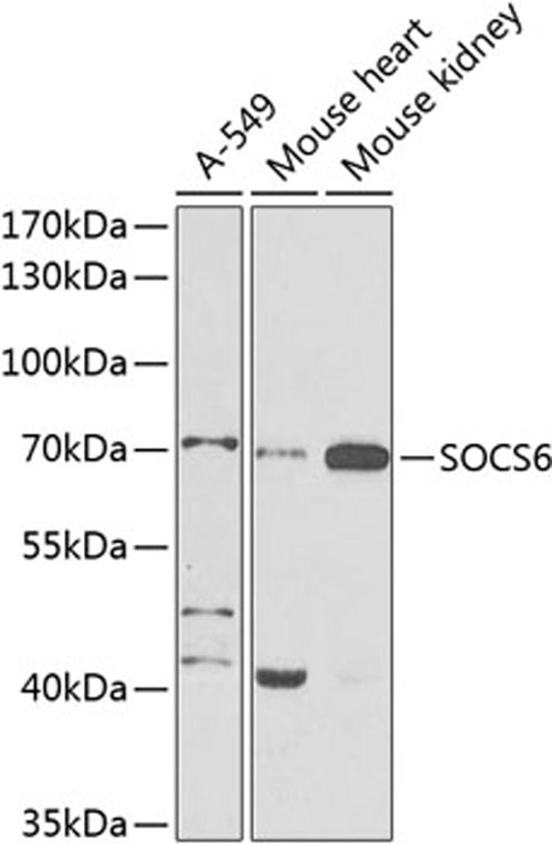 Western blot - SOCS6 antibody (A9957)