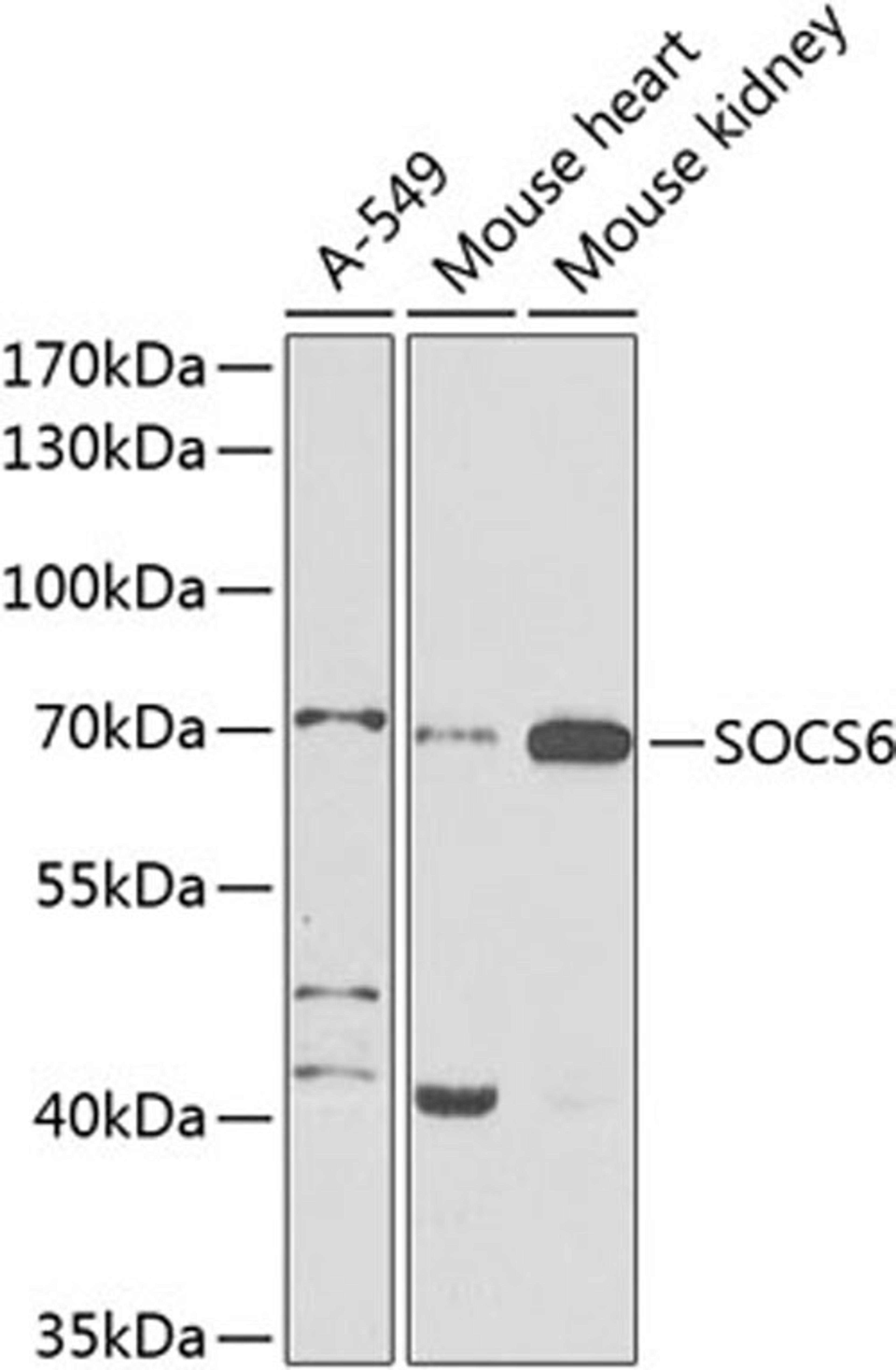 Western blot - SOCS6 antibody (A9957)