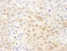 Detection of mouse Pc2 by immunohistochemistry.