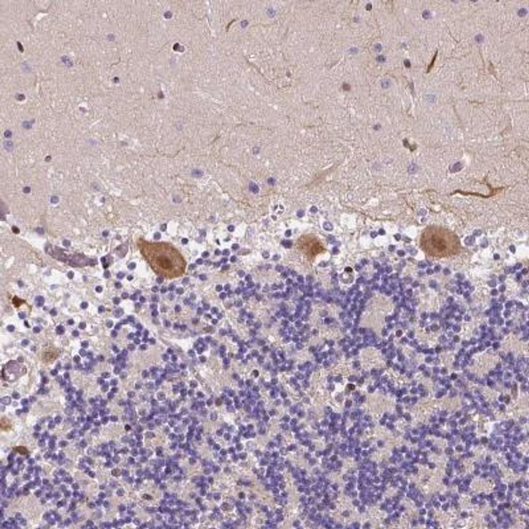 Immunohistochemistry: PANP/PILR alpha associated neural protein Antibody [NBP1-90541] - Staining shows distinct cytoplasmic and nuclear positivity in Purkinje cells.