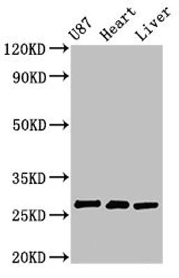 Western Blot. Positive WB detected in: U87 whole cell lysate, Rat heart tissue, Rat liver tissue. All lanes: HSCB antibody at 2.7µg/ml. Secondary. Goat polyclonal to rabbit IgG at 1/50000 dilution. Predicted band size: 28 kDa. Observed band size: 28 kDa