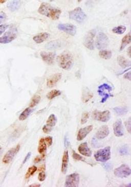 Detection of human DHX38 by immunohistochemistry.