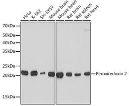 Western blot - Peroxiredoxin 2 Rabbit mAb (A4308)