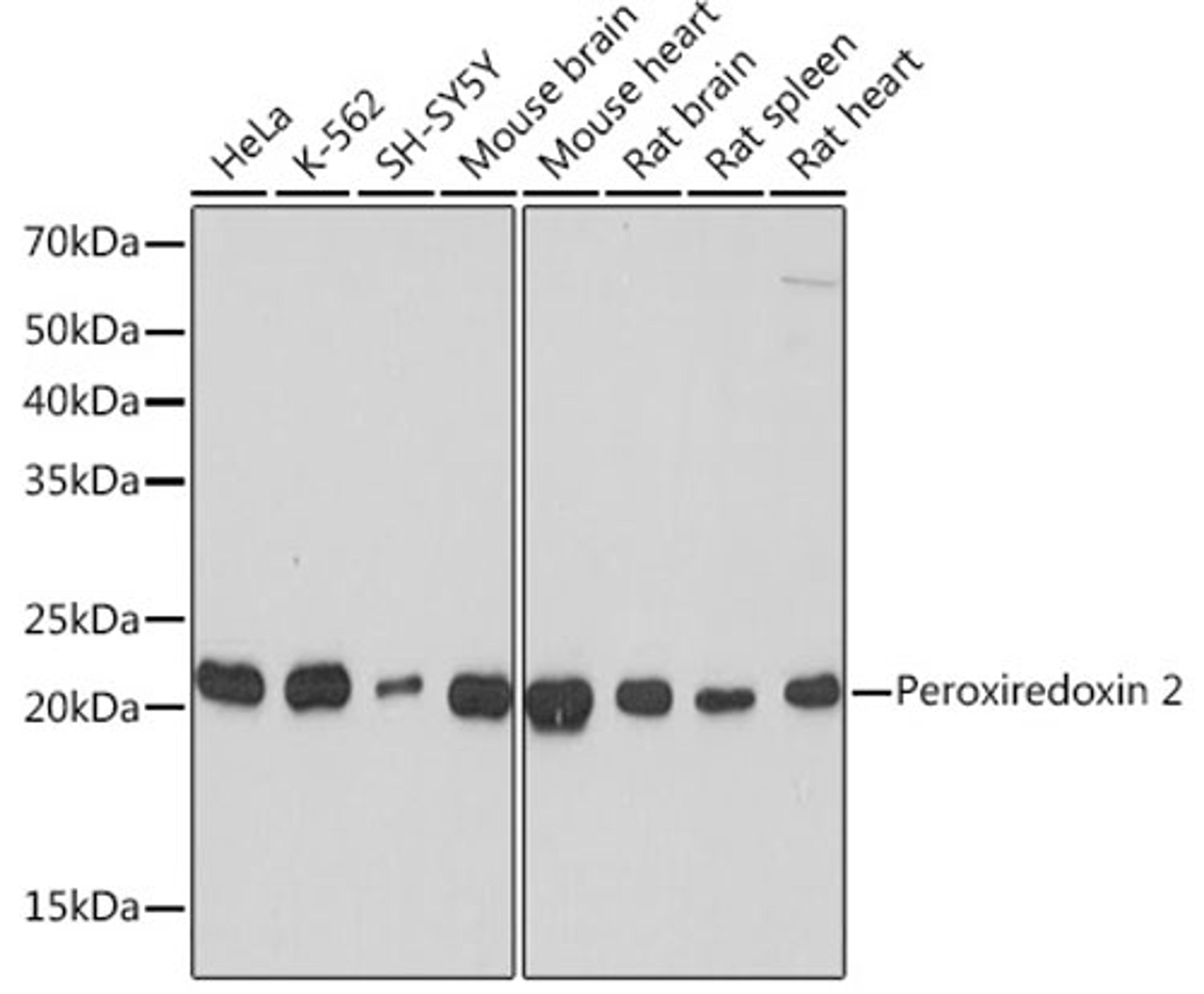 Western blot - Peroxiredoxin 2 Rabbit mAb (A4308)