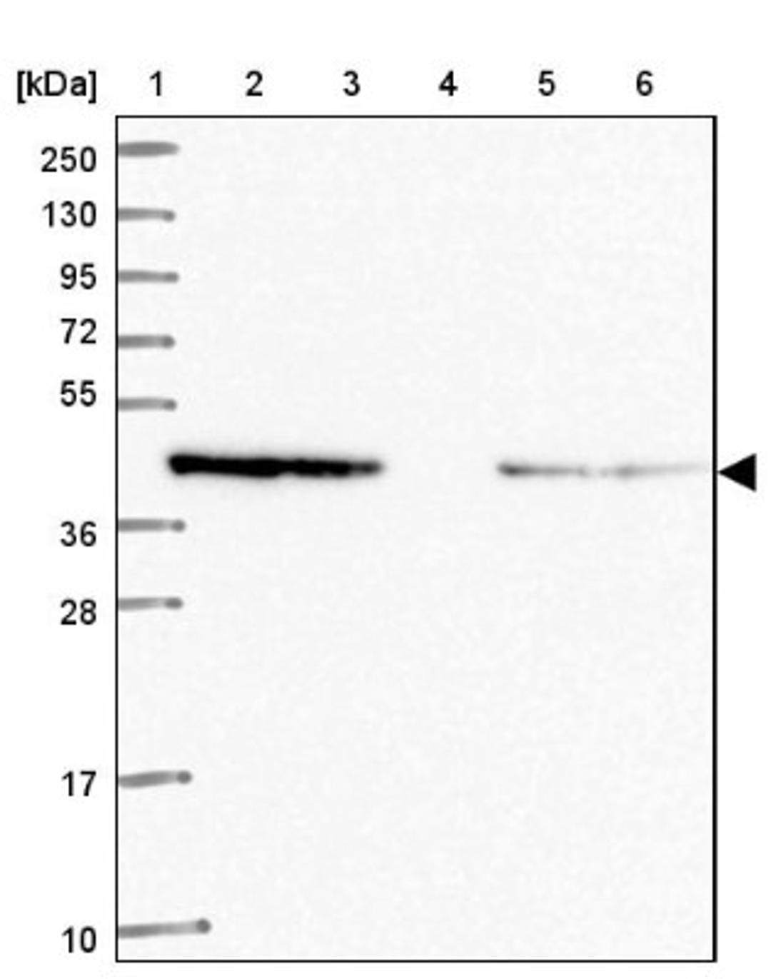 Western Blot: WWOX Antibody [NBP2-47579] - Lane 1: Marker [kDa] 250, 130, 95, 72, 55, 36, 28, 17, 10.  Lane 2: Human cell line RT-4.  Lane 3: Human cell line U-251MG.  Lane 4: Human plasma (IgG/HSA depleted).  Lane 5: Human liver tissue.  Lane 6: Human tonsil tissue.