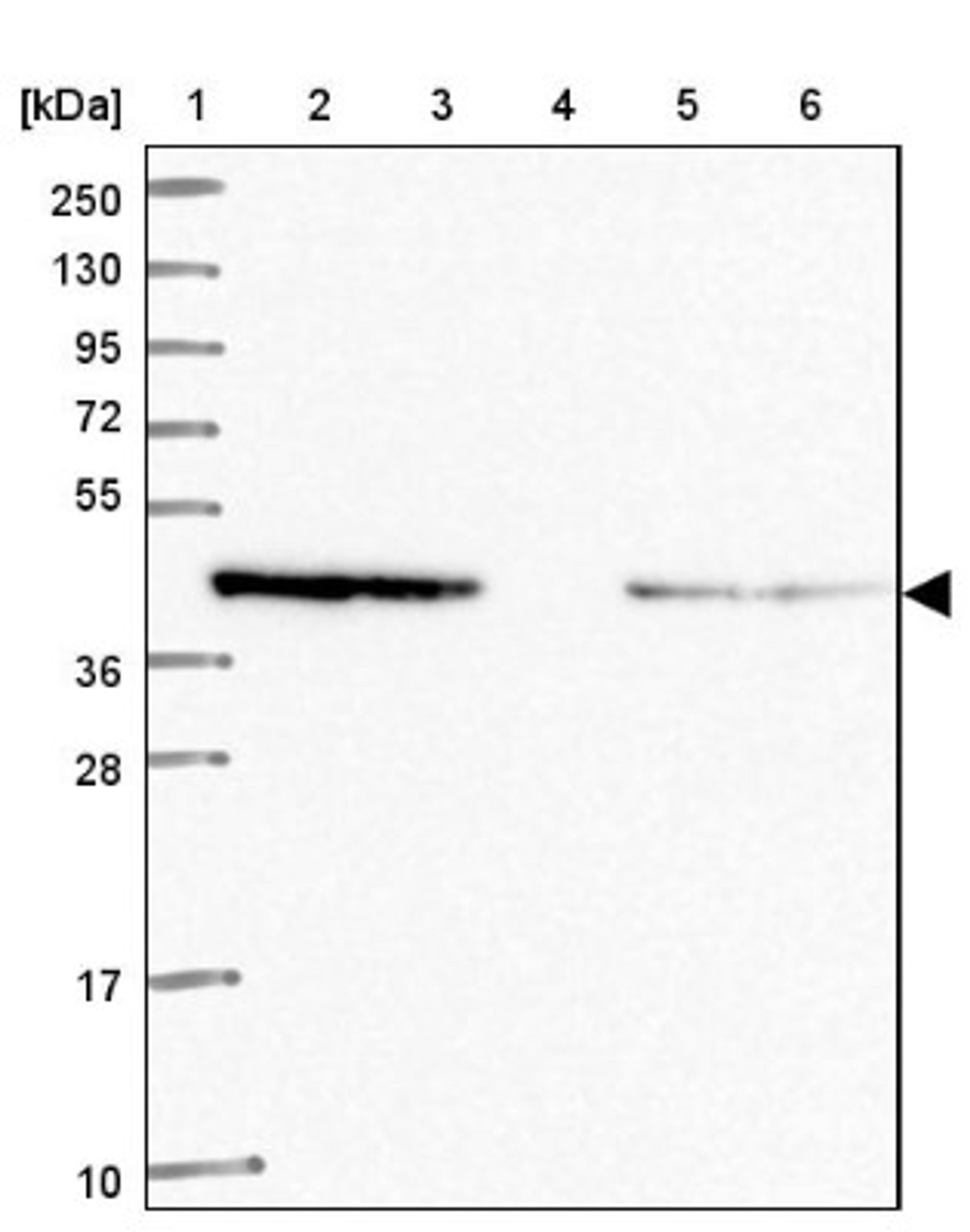 Western Blot: WWOX Antibody [NBP2-47579] - Lane 1: Marker [kDa] 250, 130, 95, 72, 55, 36, 28, 17, 10.  Lane 2: Human cell line RT-4.  Lane 3: Human cell line U-251MG.  Lane 4: Human plasma (IgG/HSA depleted).  Lane 5: Human liver tissue.  Lane 6: Human tonsil tissue.