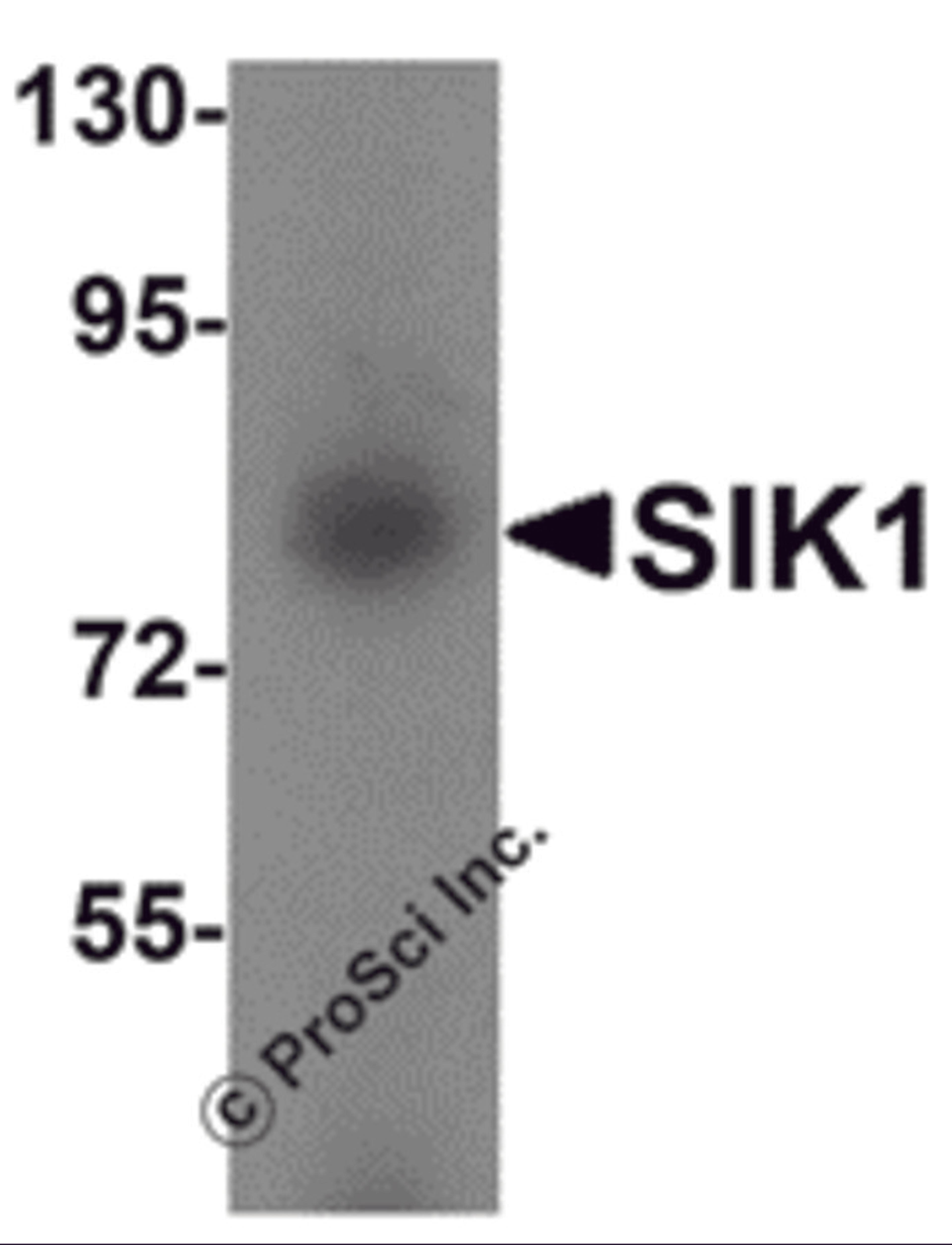 Western blot analysis of SIK1 in human small intestine tissue lysate with SIK1 antibody at 1 &#956;g/mL.