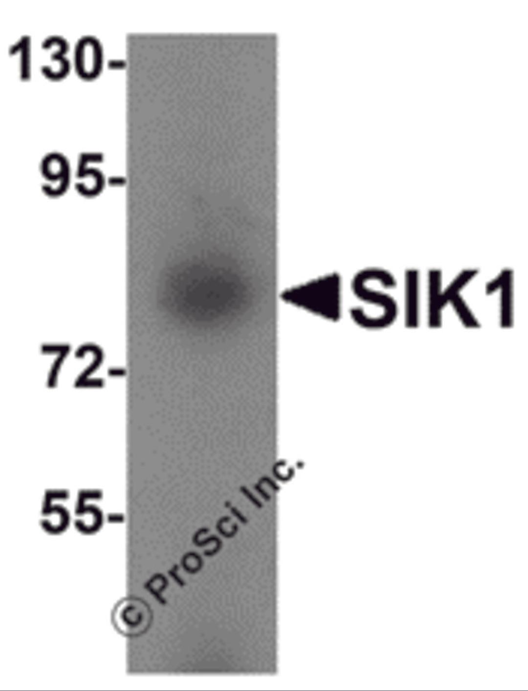 Western blot analysis of SIK1 in human small intestine tissue lysate with SIK1 antibody at 1 μg/mL.