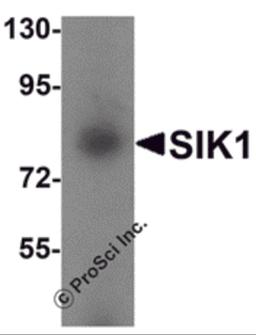 Western blot analysis of SIK1 in human small intestine tissue lysate with SIK1 antibody at 1 μg/mL.