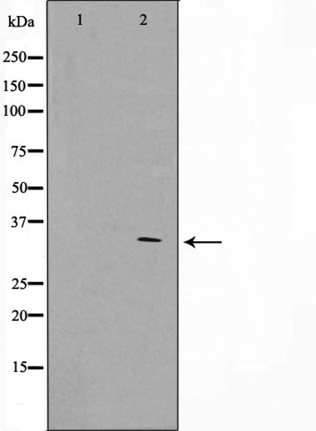 Western blot analysis of HeLa cell lysate using GFRA4 antibody