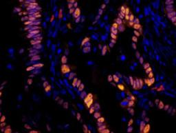 Detection of human p53 by immunofluorescence.