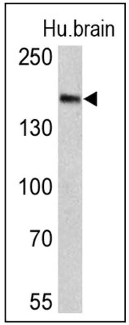 Western Blot: Clathrin Heavy Chain 1/CHC17 Antibody (X22) [NB300-613] - Analysis of 25 ug of human brain lysates.