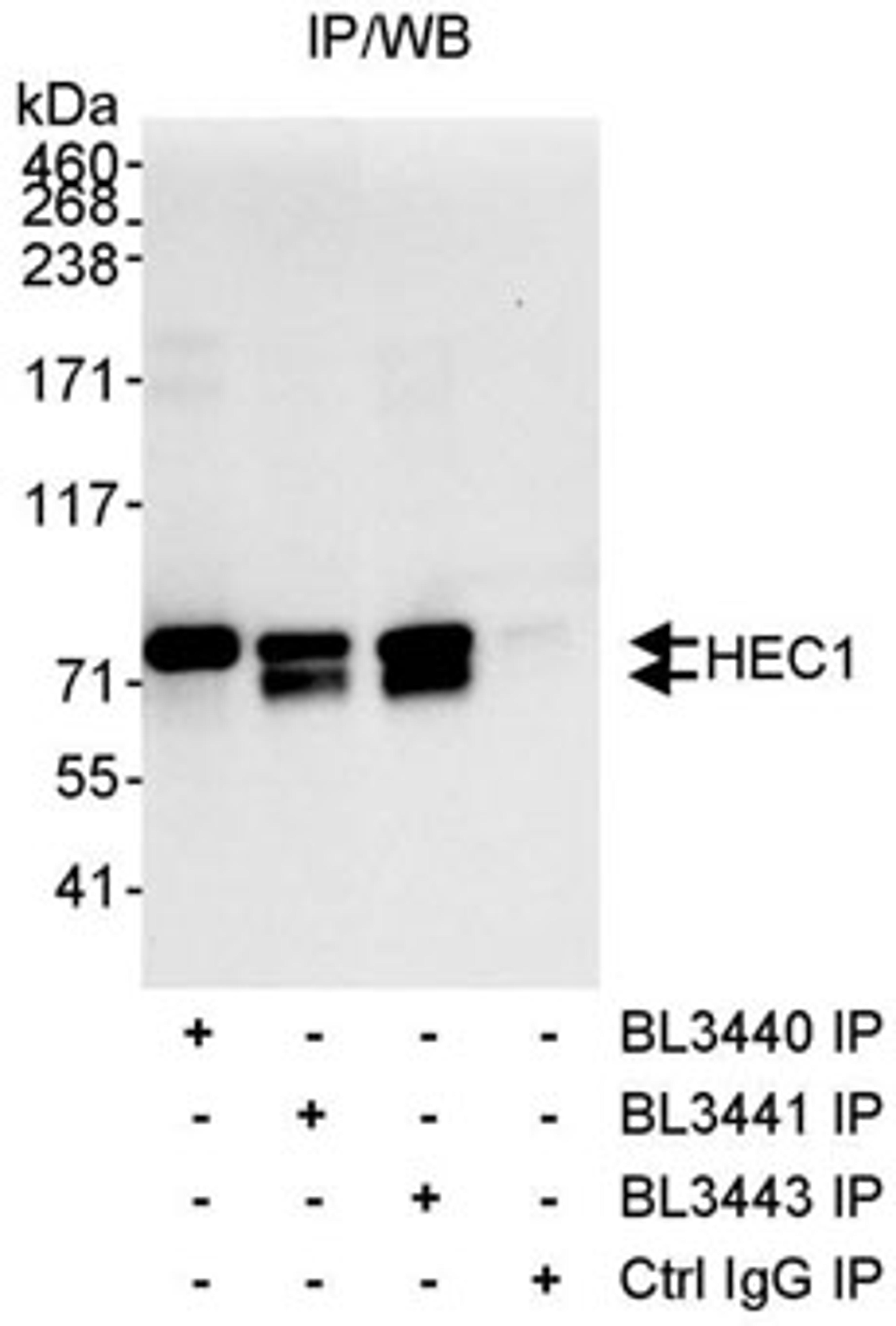 Detection of human HEC1 by western blot of immunoprecipitates.