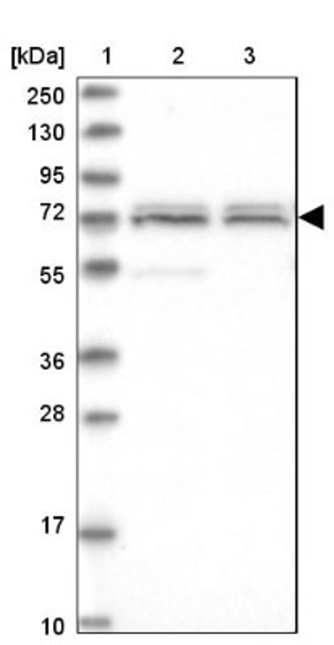 Western Blot: CDKN2A Interacting Protein Antibody [NBP1-86628] - Lane 1: Marker [kDa] 250, 130, 95, 72, 55, 36, 28, 17, 10<br/>Lane 2: Human cell line RT-4<br/>Lane 3: Human cell line U-251MG sp