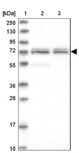 Western Blot: CDKN2A Interacting Protein Antibody [NBP1-86628] - Lane 1: Marker [kDa] 250, 130, 95, 72, 55, 36, 28, 17, 10<br/>Lane 2: Human cell line RT-4<br/>Lane 3: Human cell line U-251MG sp