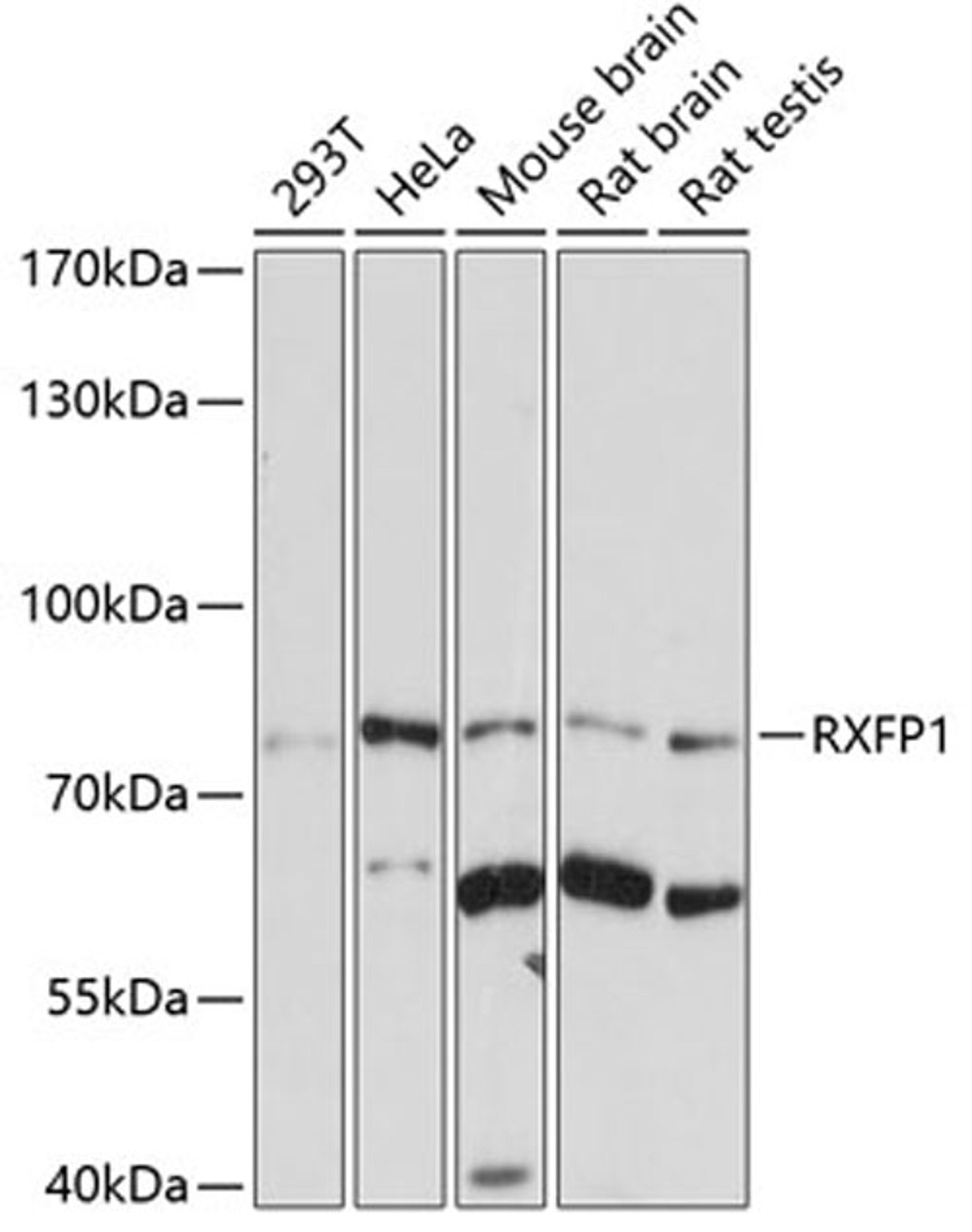 Western blot - RXFP1 antibody (A7127)