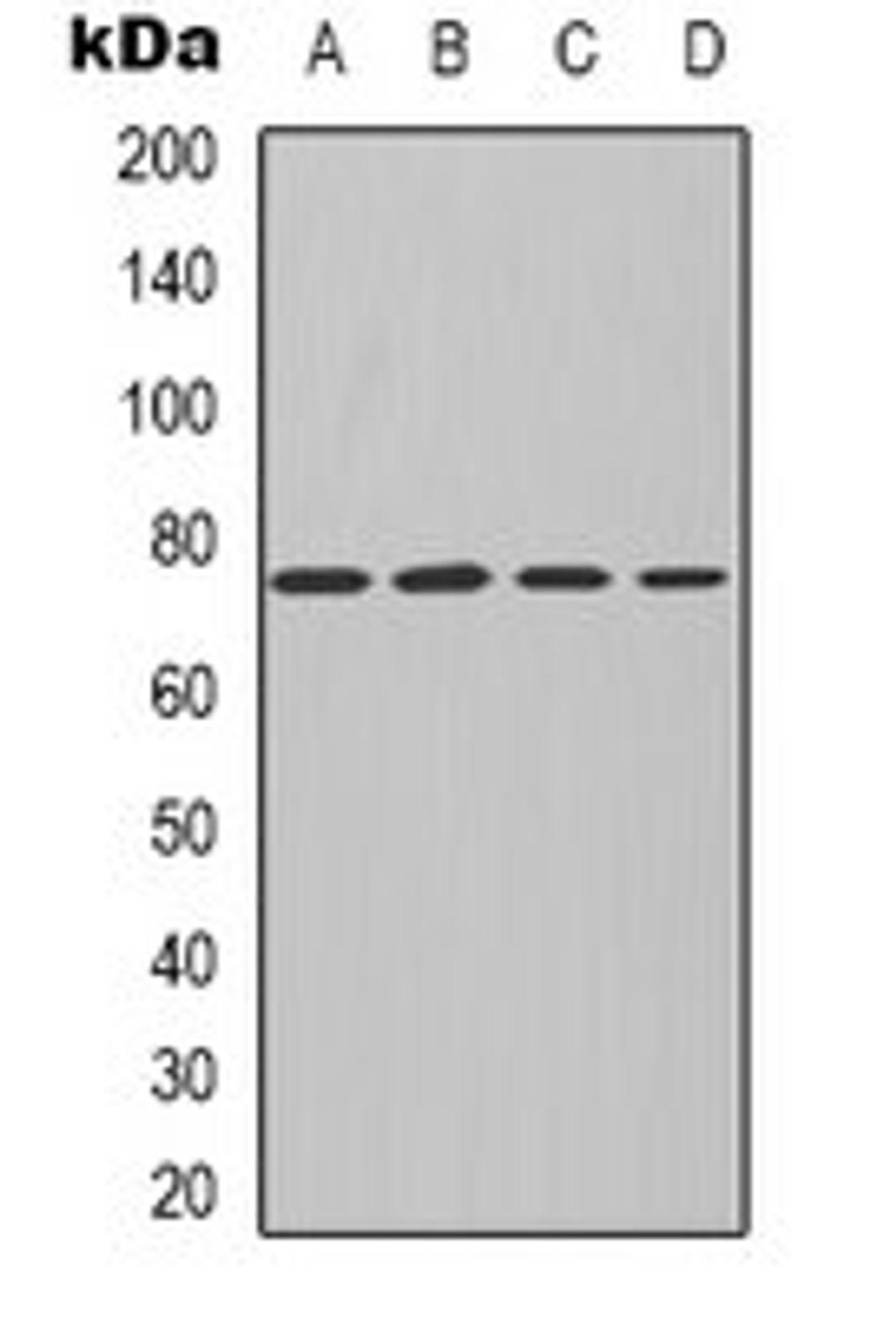 Western blot analysis of MCF7 (Lane 1), NIH3T3 (Lane 2), mouse kidney (Lane 3), rat kidney (Lane 4) whole cell lysates using PKC iota/zeta antibody