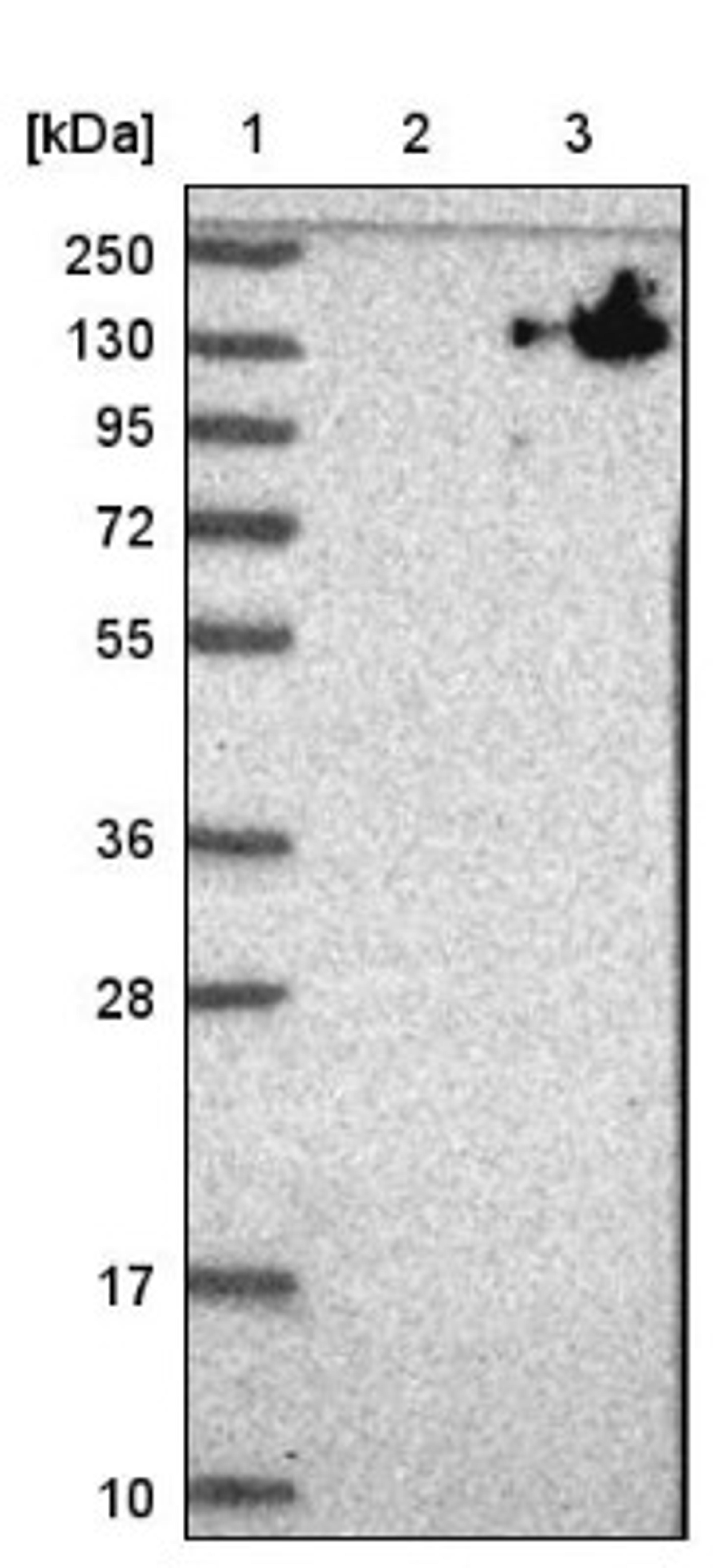 Western Blot: ZNF828 Antibody [NBP1-88403] - Lane 1: Marker [kDa] 250, 130, 95, 72, 55, 36, 28, 17, 10<br/>Lane 2: Negative control (vector only transfected HEK293T lysate)<br/>Lane 3: Over-expression lysate (Co-expressed with a C-terminal myc-DDK tag (~3.1 kDa) in mammalian HEK293T cells, LY410130)