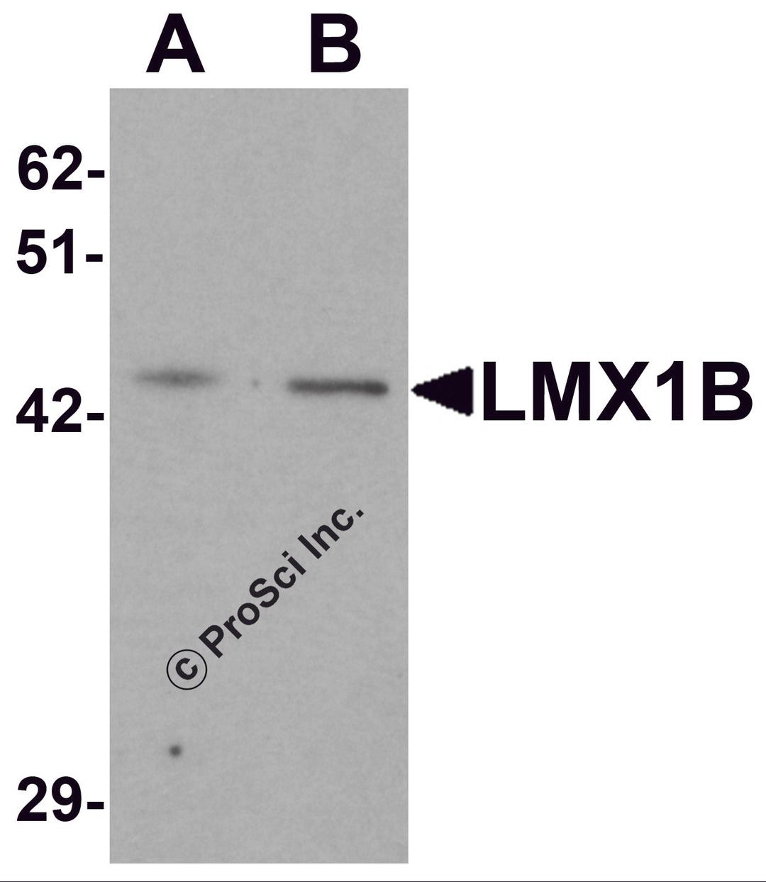 Western blot analysis of LMX1B in A-20 cell lysate with LMX1B antibody at (A) 1 and (B) 2 μg/mL.