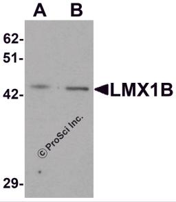 Western blot analysis of LMX1B in A-20 cell lysate with LMX1B antibody at (A) 1 and (B) 2 μg/mL.