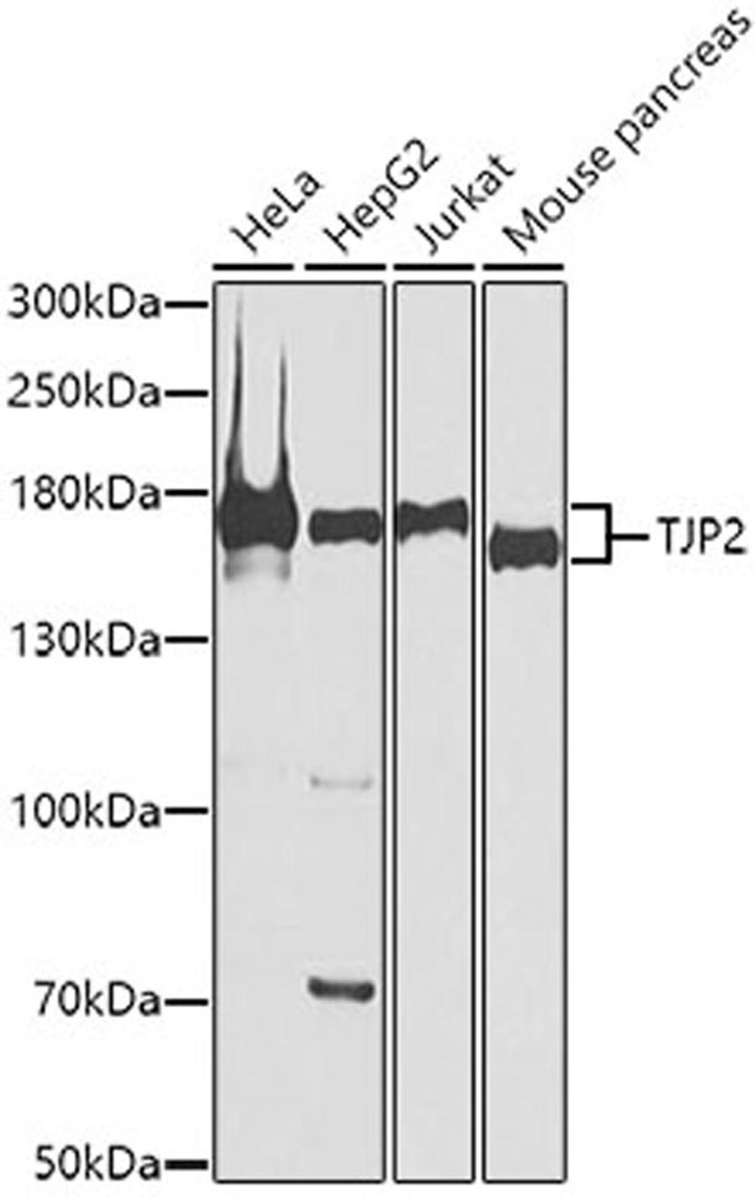 Western blot - TJP2 antibody (A0594)