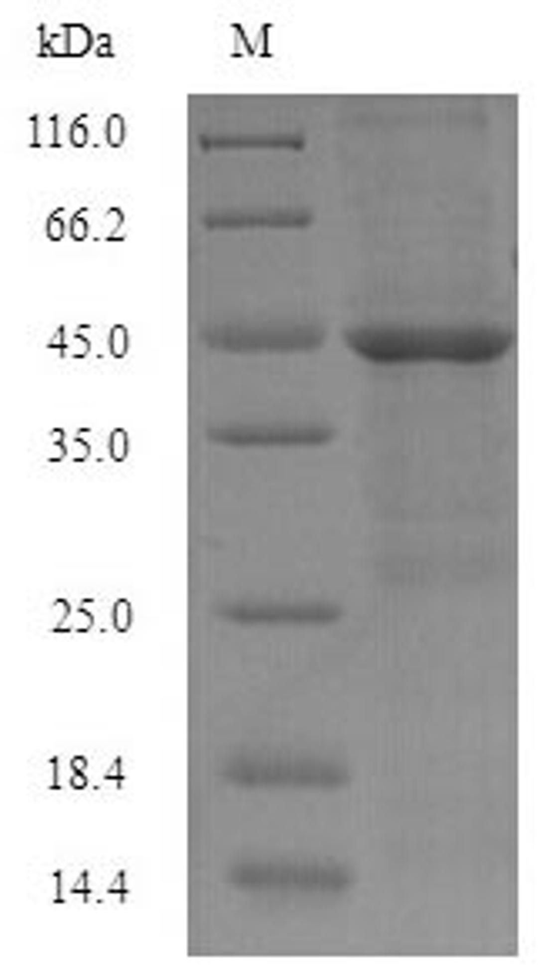 (Tris-Glycine gel) Discontinuous SDS-PAGE (reduced) with 5% enrichment gel and 15% separation gel.