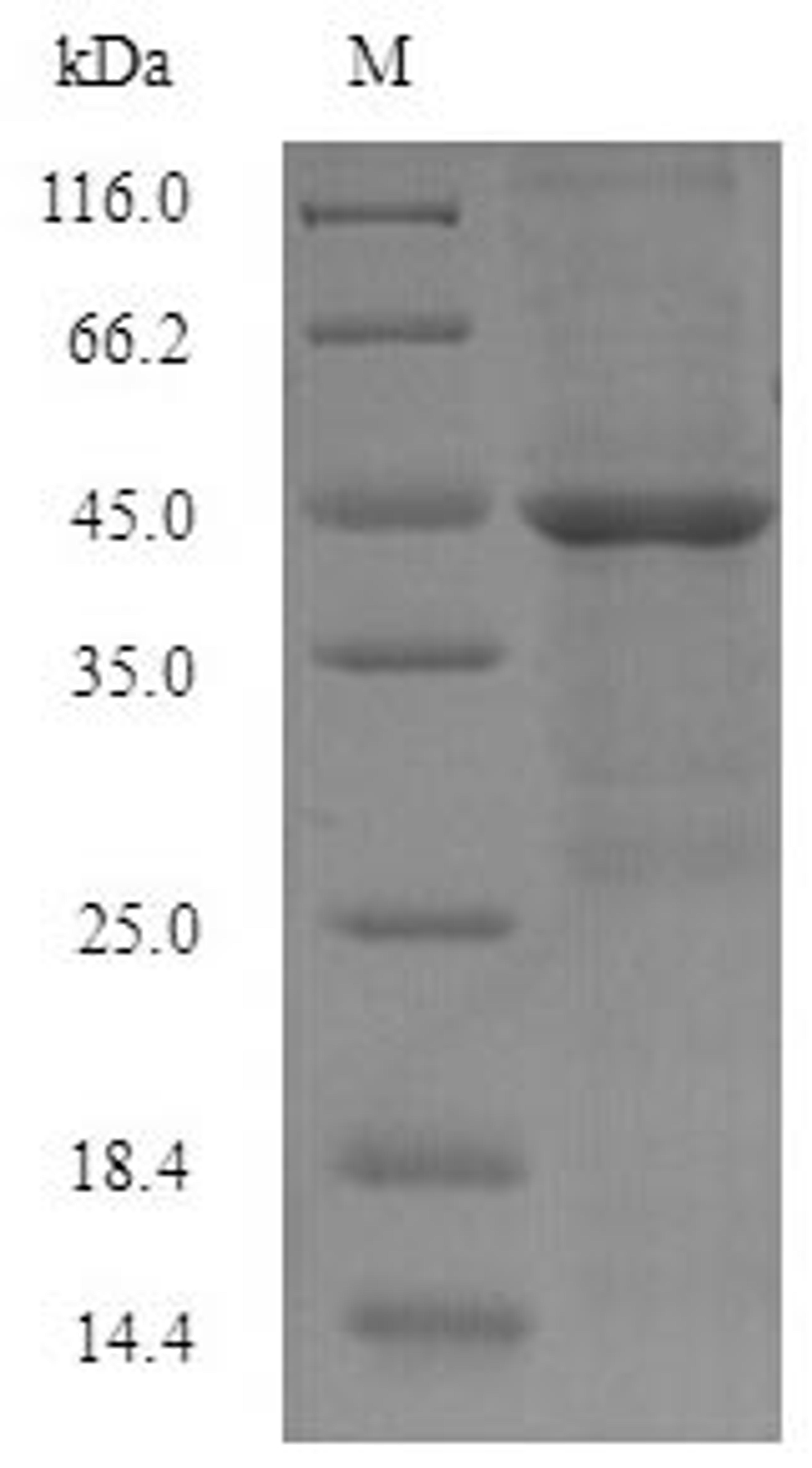 (Tris-Glycine gel) Discontinuous SDS-PAGE (reduced) with 5% enrichment gel and 15% separation gel.