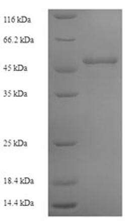 (Tris-Glycine gel) Discontinuous SDS-PAGE (reduced) with 5% enrichment gel and 15% separation gel.