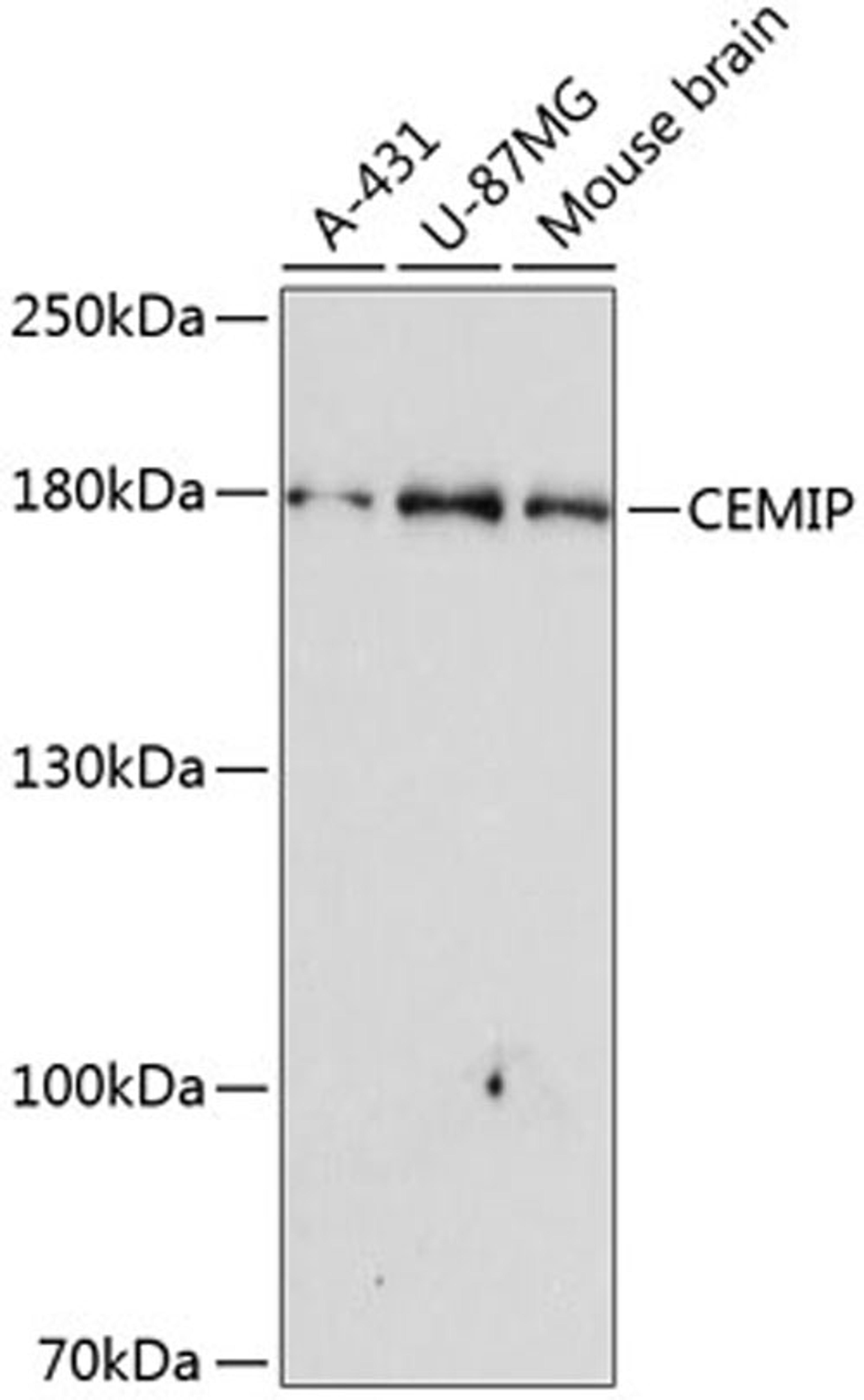 Western blot - CEMIP antibody (A8587)