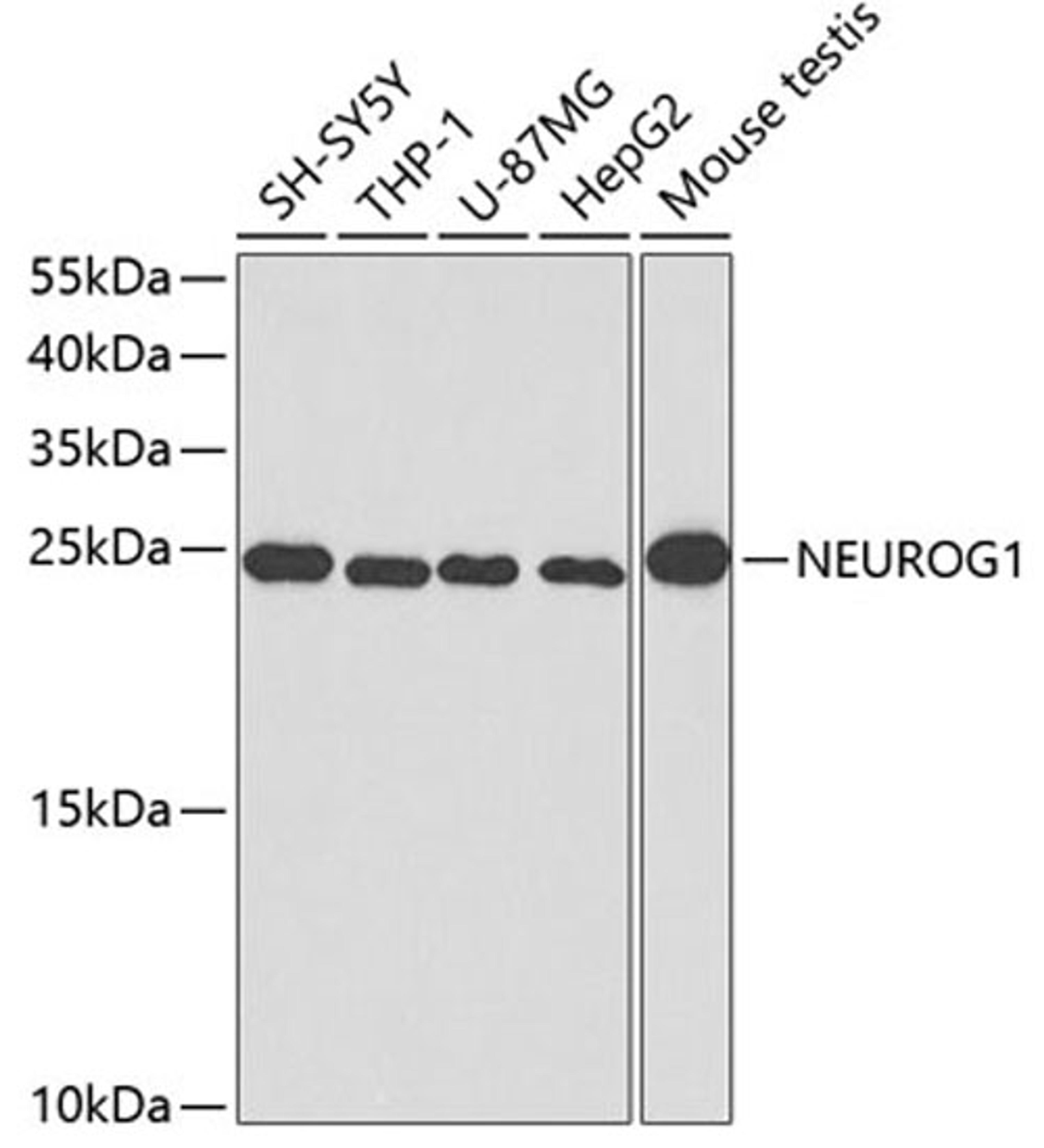 Western blot - NEUROG1 antibody (A3110)
