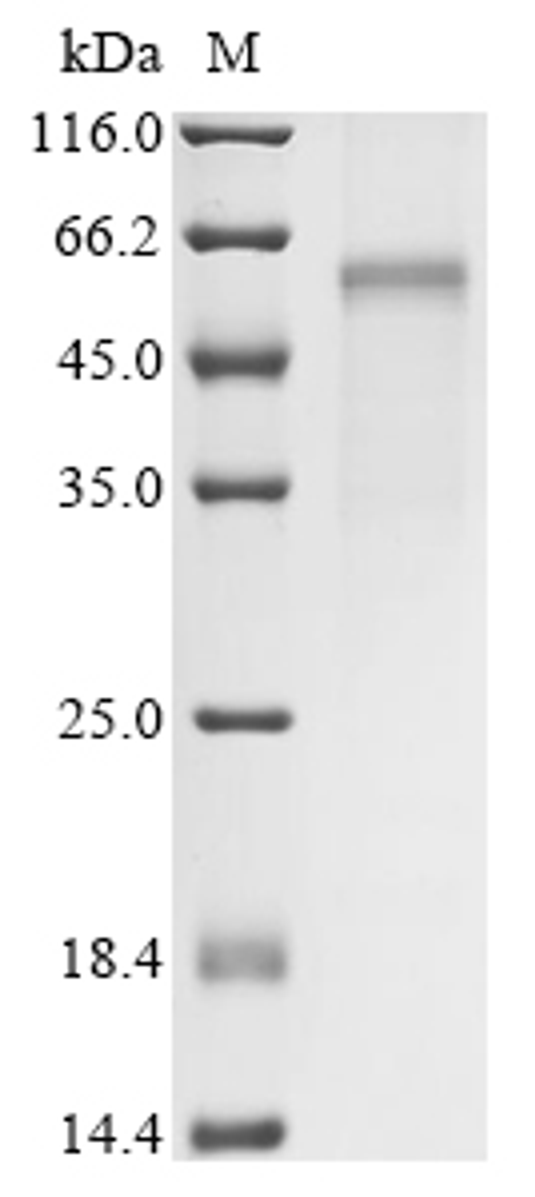 (Tris-Glycine gel) Discontinuous SDS-PAGE (reduced) with 5% enrichment gel and 15% separation gel.
