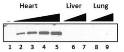 Western Blot: Myosin Heavy Chain Antibody (3-48) [NB300-284] - analysis of total cardiac myosin expression in tissue lysates of rat heart (lanes 1-5), liver (lanes 6-7), and lung (lanes 8-9). Increasing amounts of total protein were loaded as follow: lanes 1, 6 and 8: 0 ug; lane 2: 50 ug; lanes 3 , 7 and 9: 250 ug; lane 5: 500 ug. (anti-cMHC was used at 1:500; secondary antibody: Goat anti-mouse IgG Fc-HRP; 1:5000)