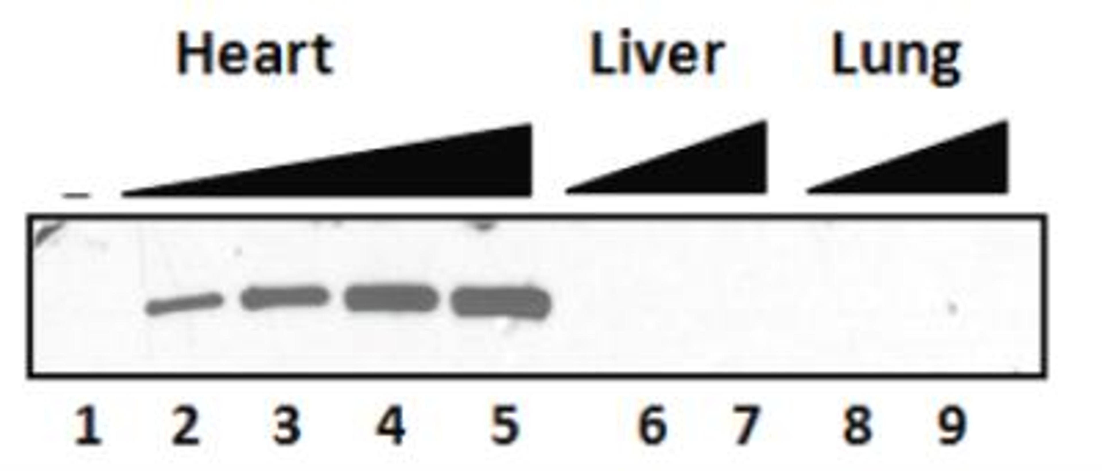 Western Blot: Myosin Heavy Chain Antibody (3-48) [NB300-284] - analysis of total cardiac myosin expression in tissue lysates of rat heart (lanes 1-5), liver (lanes 6-7), and lung (lanes 8-9). Increasing amounts of total protein were loaded as follow: lanes 1, 6 and 8: 0 ug; lane 2: 50 ug; lanes 3 , 7 and 9: 250 ug; lane 5: 500 ug. (anti-cMHC was used at 1:500; secondary antibody: Goat anti-mouse IgG Fc-HRP; 1:5000)